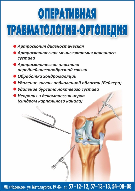 Артроскопия левого коленного сустава. Артроскопия коленного сустава: подготовка и проведение Артроскопия коленного сустава: основные аспекты, диагностика, операции. Артроскопия коленного сустава: цена операции на колене в центре в Москве