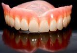 После неудачного протезирования череповчанка отсудила у стоматологов полмиллиона 