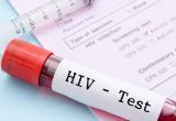 Может ли человечество избавиться от ВИЧ и гепатита B? Мнение экспертов