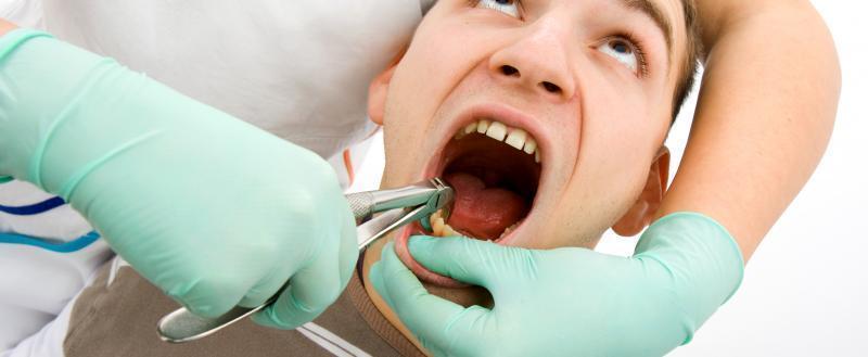 Череповчанин засудил частную стоматологическую клинику за оказание некачественных услуг