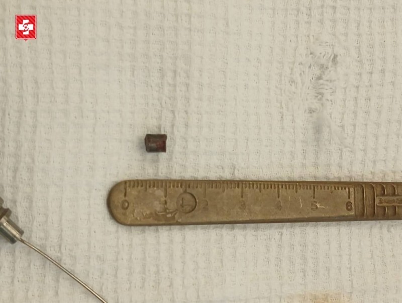 Нейрохирурги Вологодской области спасли бойца СВО с осколком в позвоночнике