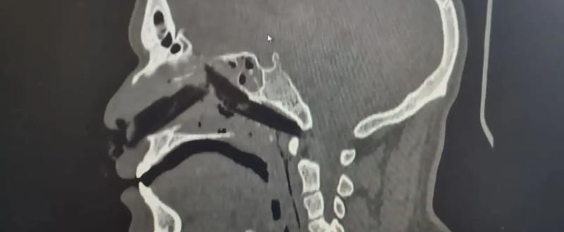 Вологодская областная клиническая больница