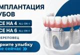 Полную потерю зубов сегодня можно компенсировать современной имплантацией