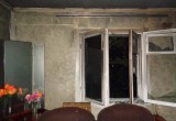 Юноша попал в реанимацию с ожогами 90% тела после пожара в одном из поселков Вологодчины