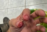 "Отрезал кончики пальцев": череповецкий конькобежец получил травму во время колки дров