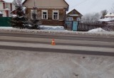 В Белозерске 10-летняя девочка попала под колеса автомобиля